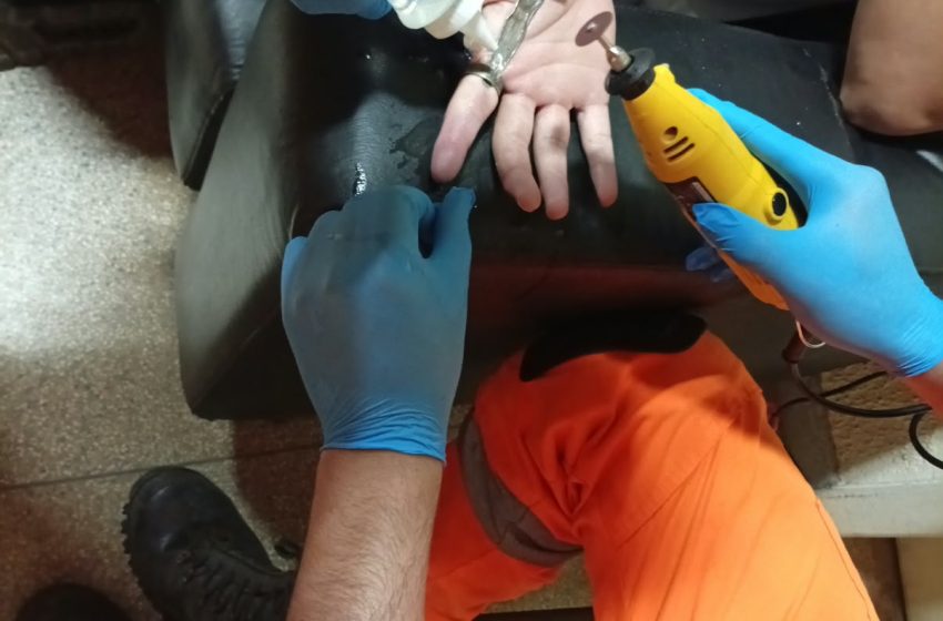  Bombeiros resgatam dedo de jovem preso em anel durante a noite